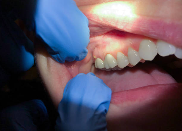 Best Emergency Dental Services Near Me  in Mount Gilead, OH