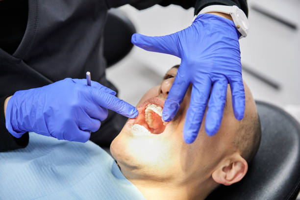 Best Teeth Whitening  in Mount Gilead, OH