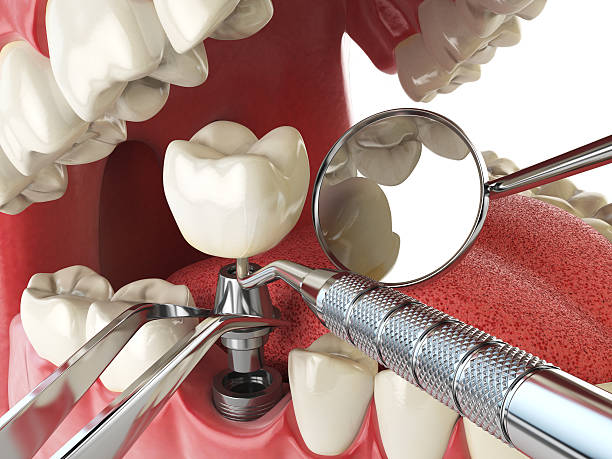 Best Emergency Gum Pain Relief  in Mount Gilead, OH